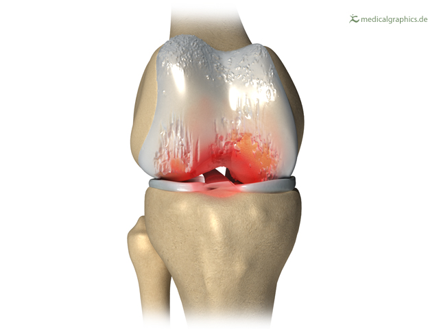 www.medicalgraphics.de – Copyright Notice – creative commons CC BY-ND 3.0